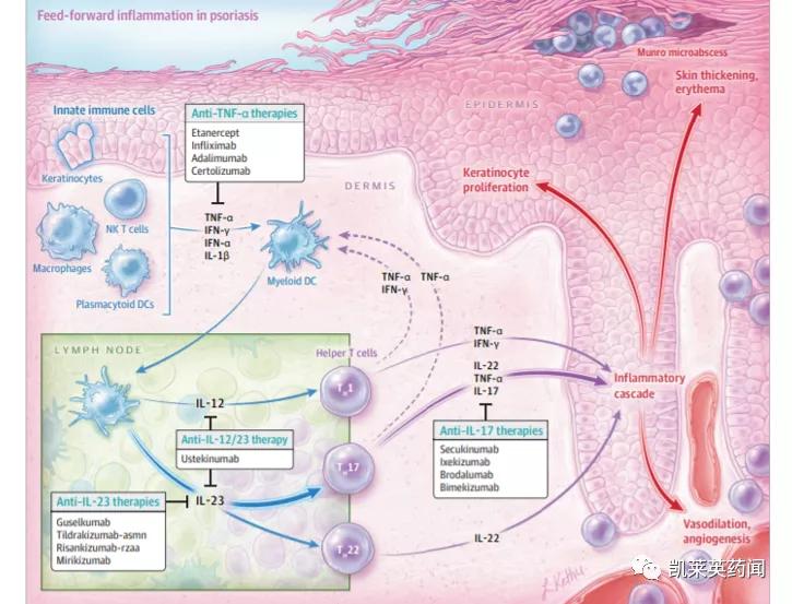 银屑病目前最好的特效药生物制剂,全球最新银屑病新药