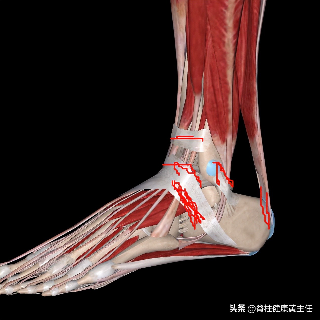 踝关节扭伤脱位手法复位视频,踝关节扭伤手法复位多久可以运动