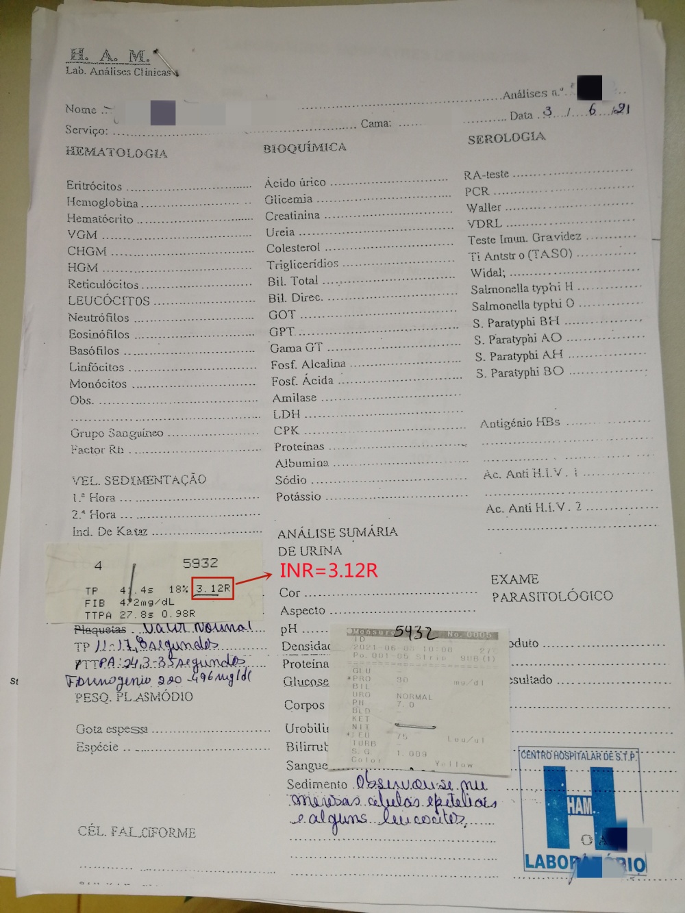 成医附院援外医疗｜蒋利成圣普纪行二：灵活测算INR值指导用药