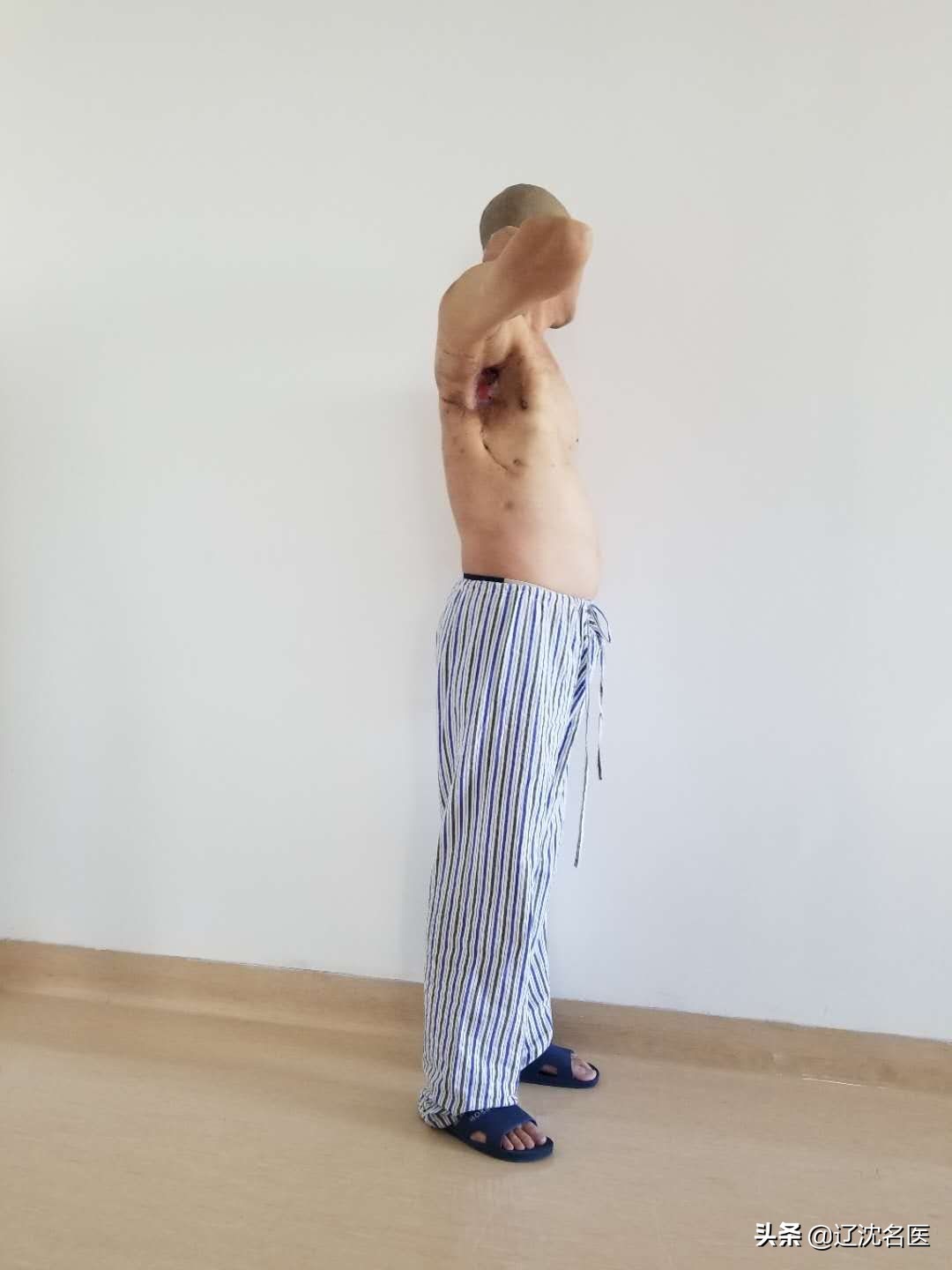 男子被病魔折磨10年,男人被病痛折磨20年