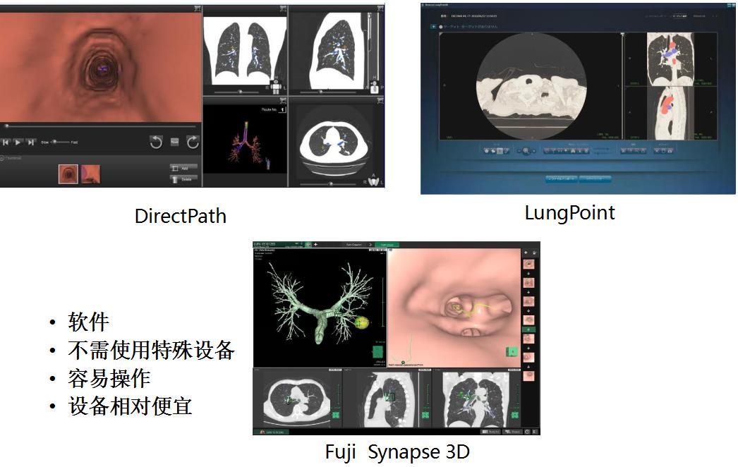 支气管镜高频电刀治疗中央型肺癌,支气管镜在早期肺癌诊断的意义