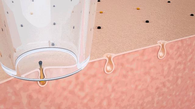 草莓鼻去黑头排行榜第一名,草莓鼻去黑头什么产品效果最佳