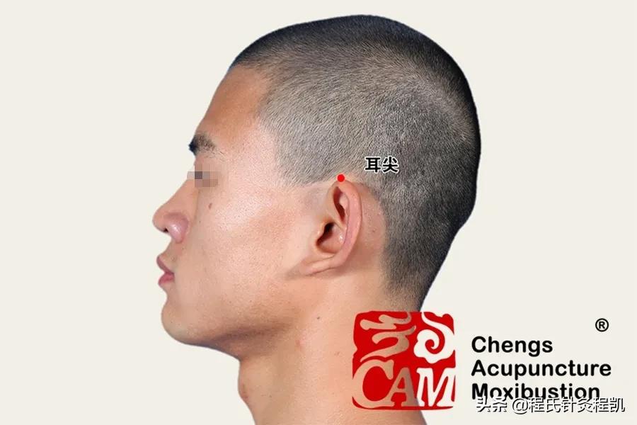 程凯养生说颈椎病视频,程凯养生说谈脑梗