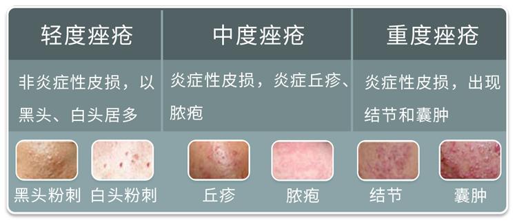 不同部位长痘痘的原因及解决方法,不同地方长痘痘的原因和改善方法