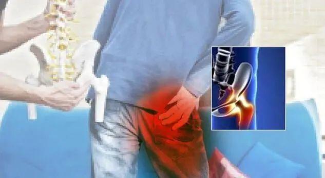 股骨头坏死打孔减压术后恢复多久,股骨头坏死大腿肌肉萎缩能恢复吗