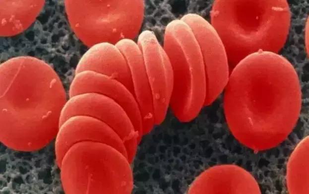 献血帮助别人的同时也要注意身体,献血有助于健康是真的吗