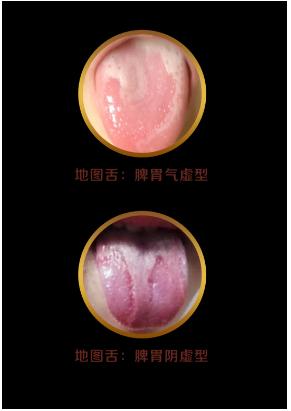 舌头有舌象是什么原因,怎么判断宝宝舌象是否正常