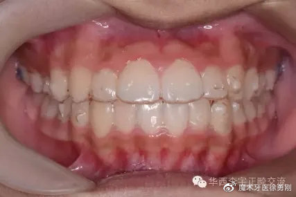 铜川乡*党**，矫牙前，请一字不漏读完这篇！