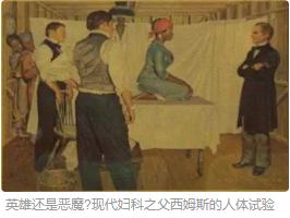 惊叹“鸭嘴形窥器”的前世今生