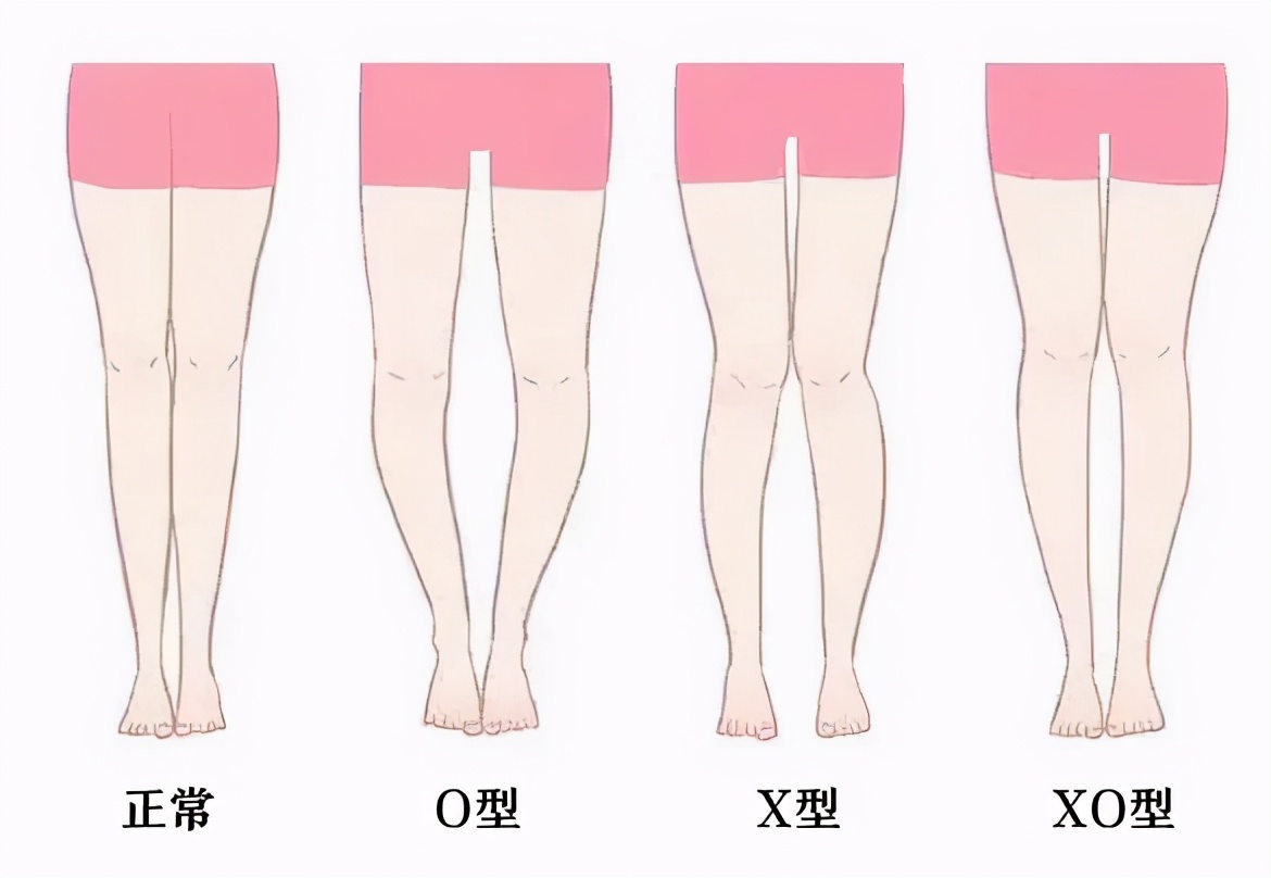 如何使腿部变得纤细,怎么让腿部变好看