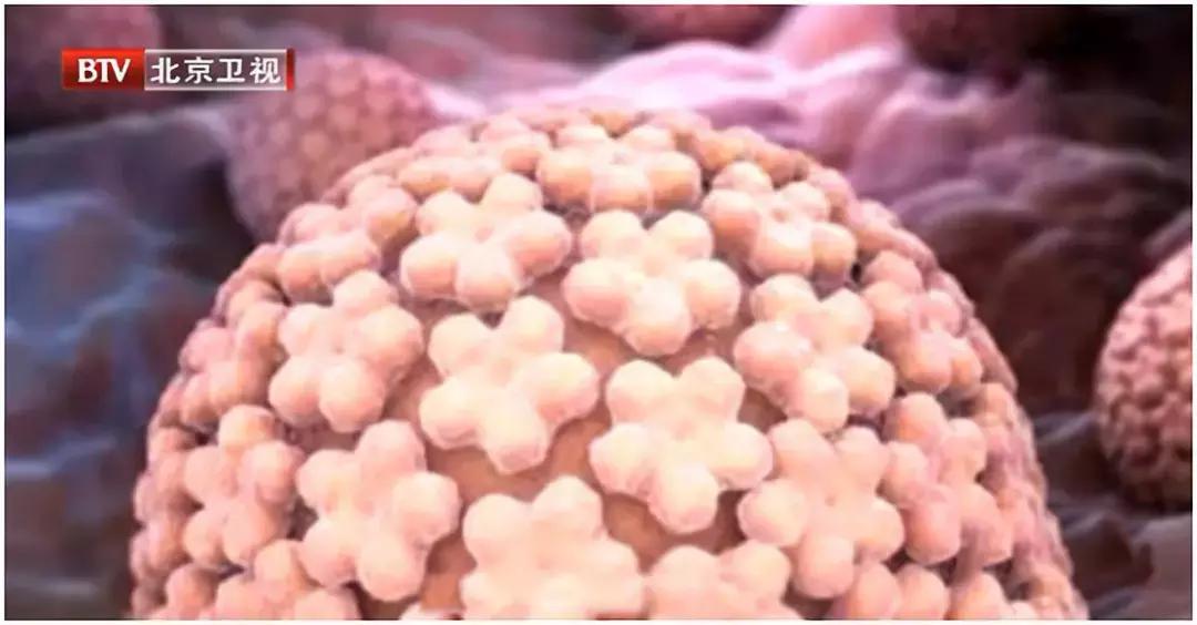 专家教你怎么预防宫颈癌,专家讲如何预防宫颈癌