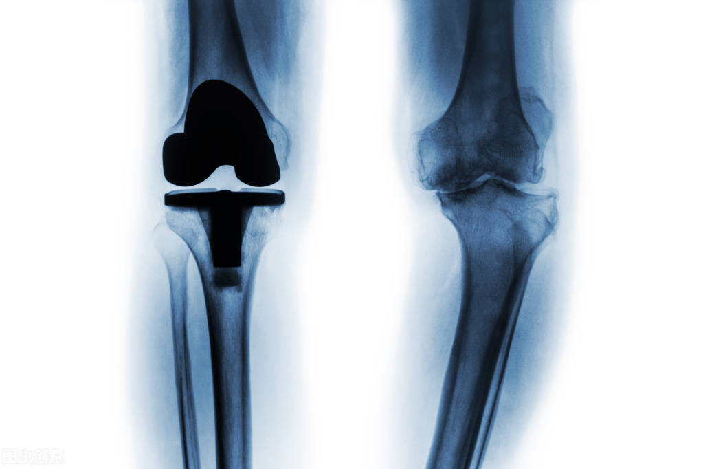 全国门诊慢特病相关治疗费用跨省,门诊慢特病医疗费用