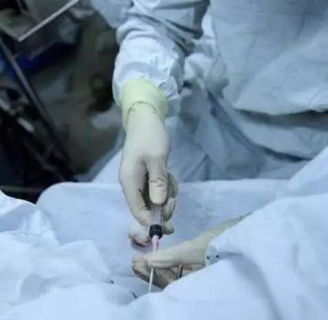 做了无痛人流手术后要注意什么,做了人流手术后应该注意保暖吗