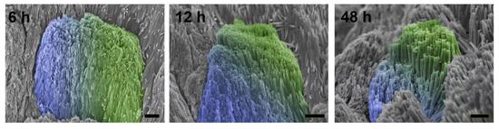 神奇的治牙药水,牙齿修复液可以修复根断的牙齿吗