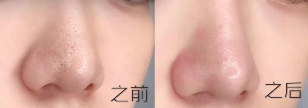 抖音上爆火去螨虫黑头的洗面奶,全网很火男生洗面奶