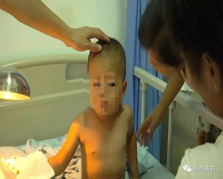 广西一3岁男童在路边玩不慎被石头砸断三根手指