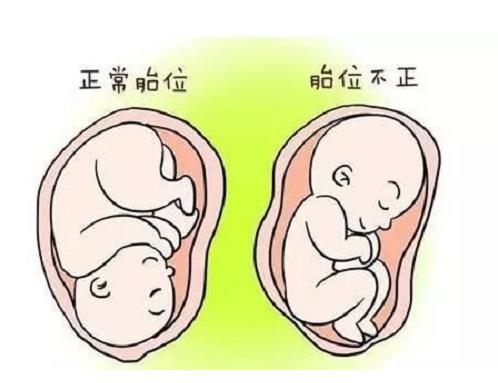 孕期需要注意些什么,孕期注意事项及禁忌