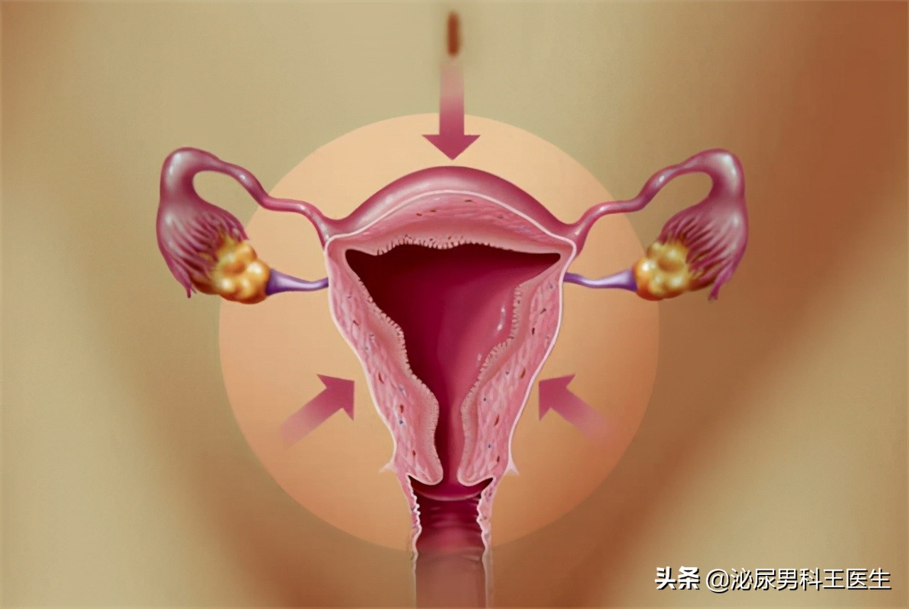 感染hpv病毒就一定会得宫颈癌吗,感染hpv容易宫颈息肉吗