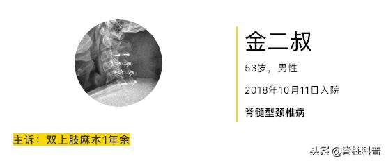 颈椎病治疗的分享,关于颈椎病通俗易懂的科普