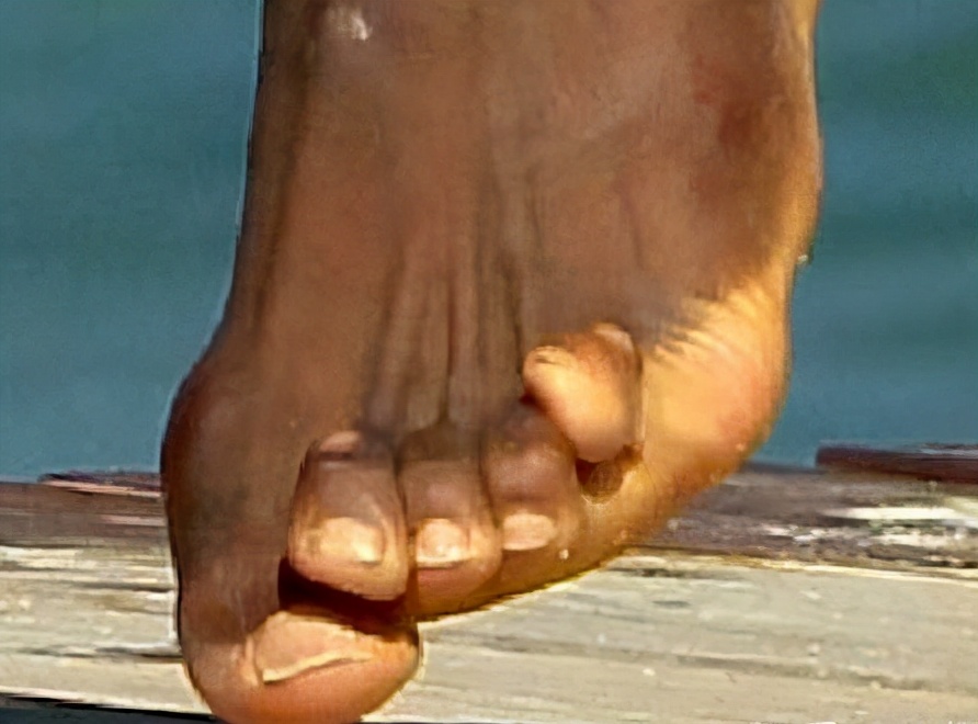 博尔特为什么会消失,博尔特为啥右腿起跑