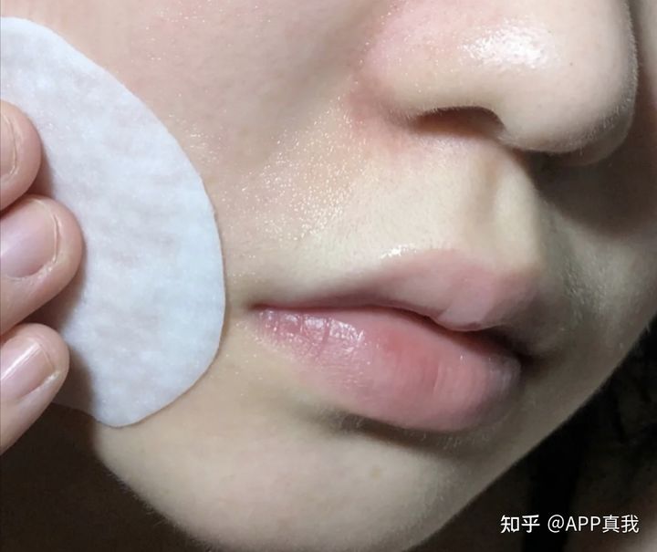 刷酸的作用效果持续多久,刷酸一次效果能维持多久