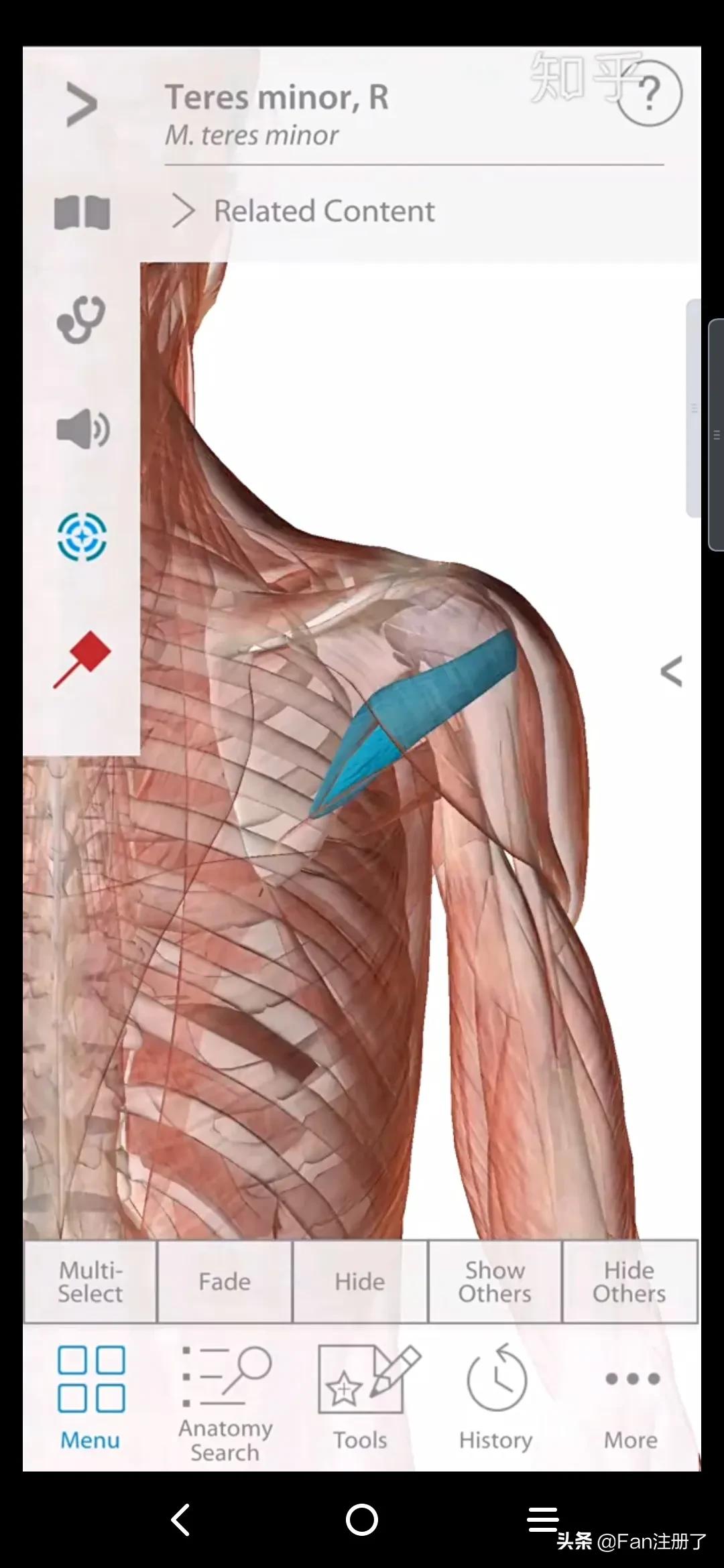 肩痛肩袖损伤针刀治疗,肩痛肩关节活动受限用什么药