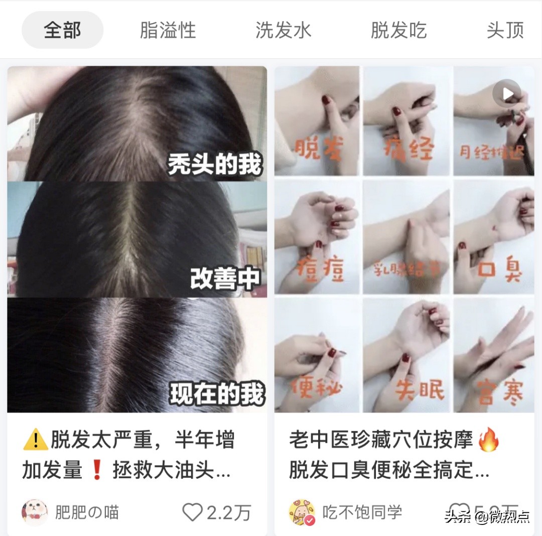 我国超25亿人受脱发困扰,我国超2.5亿人脱发