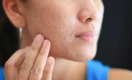 分清自己的肤质秋季更好护肤,秋季护肤到底是先补水