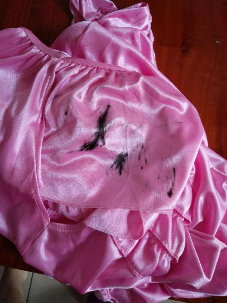 用84怎么去除白衣服上的顽固污渍,棉白衣服上的污渍怎么去除小窍门