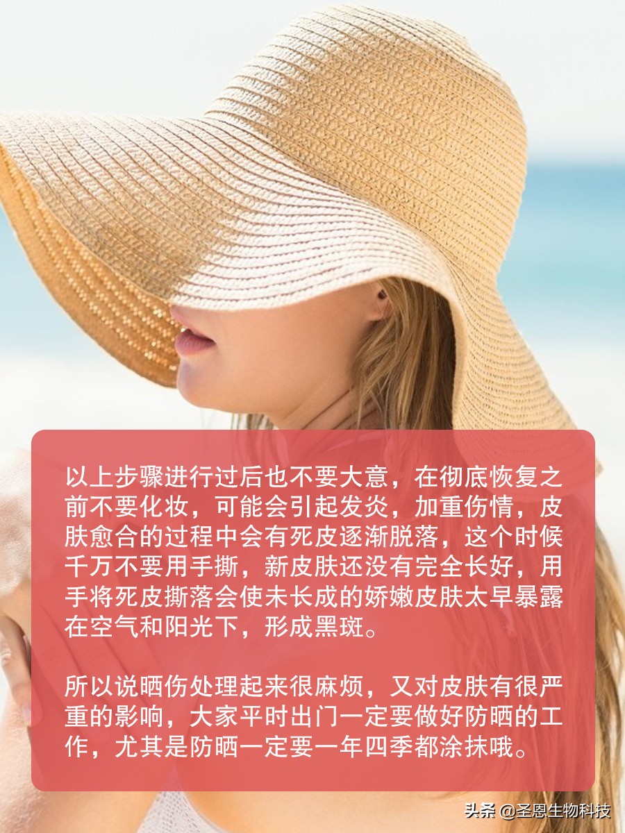 皮肤晒伤紧急处理方法,皮肤晒伤紧急处理办法