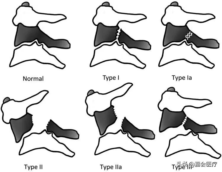 她被判处绞刑，吊了半小时却没死，这个医生说出了真相