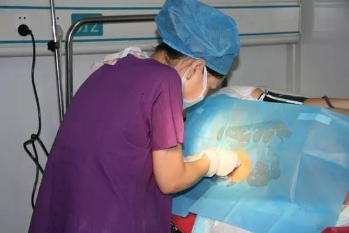 关于无痛分娩，你想知道什么