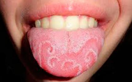 关于舌苔知道身体健康的视频,舌苔是健康的晴雨表吗