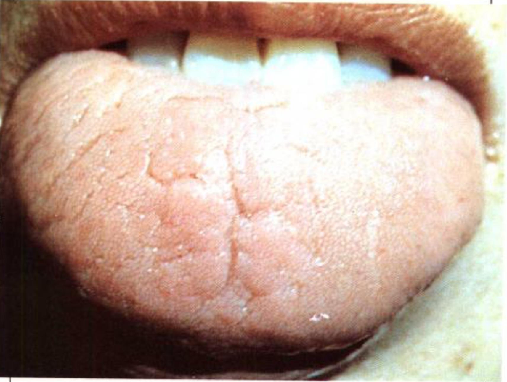 如何从舌苔判断健康,怎样通过舌苔颜色判断身体状况