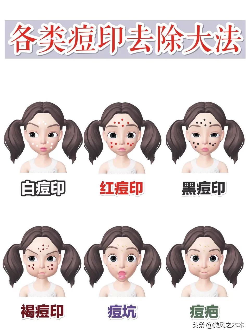 痘印痘坑消除要做多少次医美,去痘印痘坑痘疤的医美方法