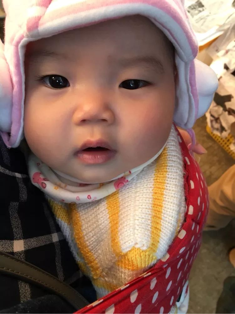 宝宝双眼不一样大,宝宝眼睛大小不一样什么原因