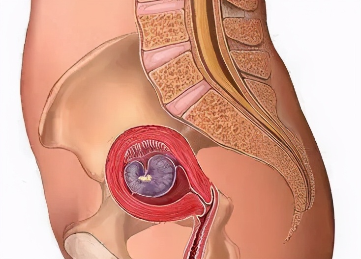 每个新手妈妈都要经历的“恶露”，它到底是什么？