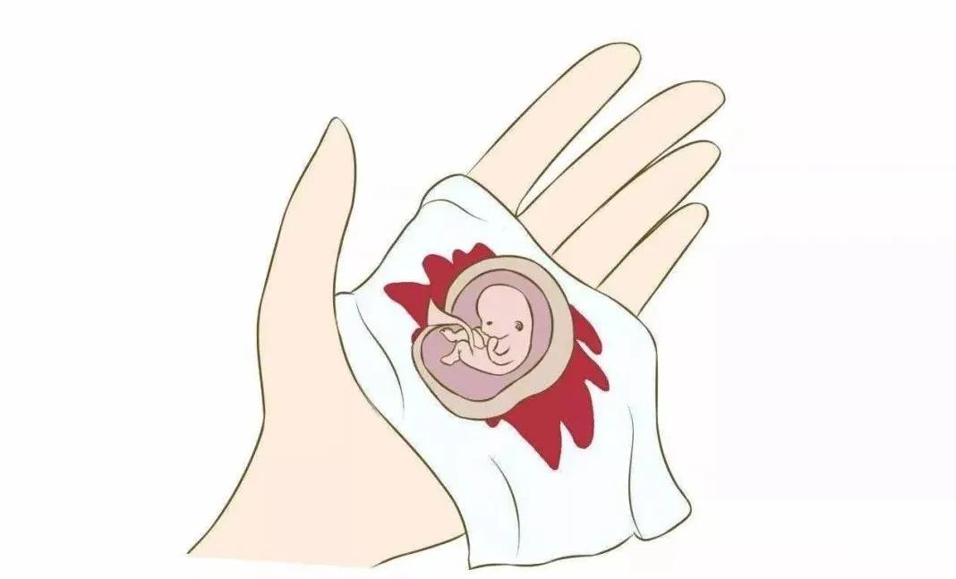 自己堕胎用什么药,自己在家熬堕胎药可以吗