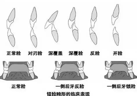 helen榻跨,Helen榻跨涓績