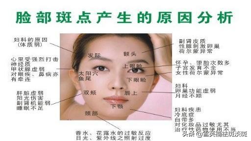 如何快速祛斑最有效的方法,脸上祛斑方法教你如何轻松祛斑