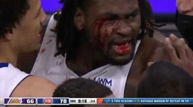 以赛亚斯图尔特能力图,以赛亚斯图尔特为什么叫弑君者