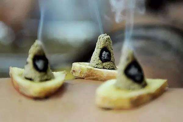 溃疡性结肠炎艾灸几个疗程有效,溃疡性结肠炎能艾灸神阙穴吗