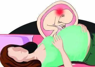 宝宝喜欢歪脖怎么回事,怎么判断宝宝是不是歪脖