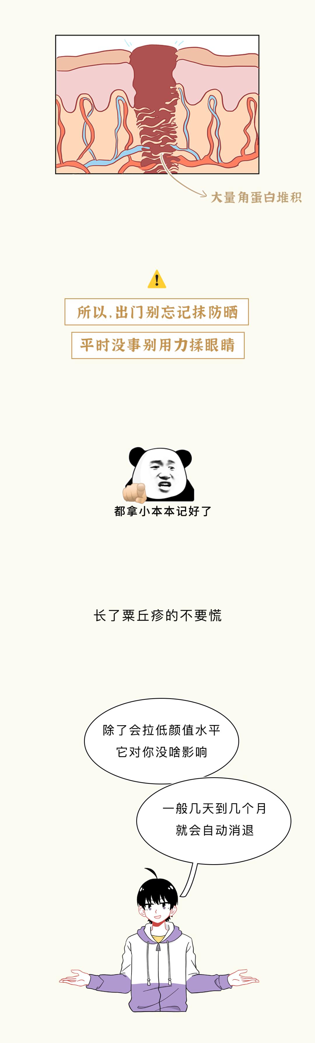 眼睛周围的脂肪粒到底是啥,小孩眼睛周围长很多脂肪粒