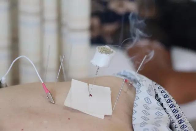 三伏天中医三伏贴,江苏省中医院可以预约三伏贴吗