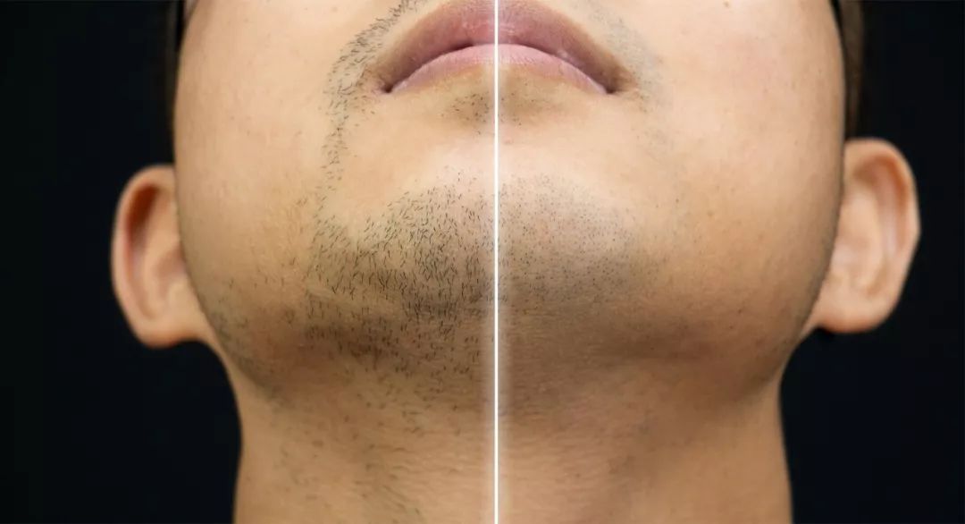 飞利浦s9000剃须刀刀头怎么拆开,飞利浦s9000剃须刀怎么连接蓝牙