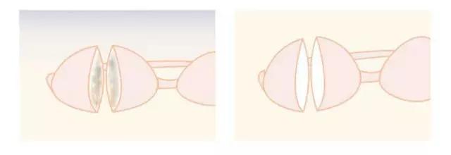 73岁人大代表研发洗衣神器，十年油汗渍霉菌，异味顽垢，轻松泡走