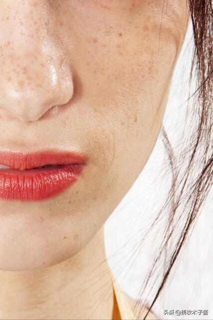 25岁身体各种毛病,20岁皮肤容易出现的问题