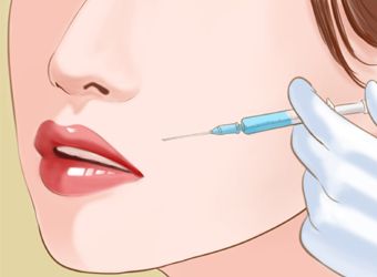 法令纹怎样淡化效果最好,有法令纹了怎么改善真实有效