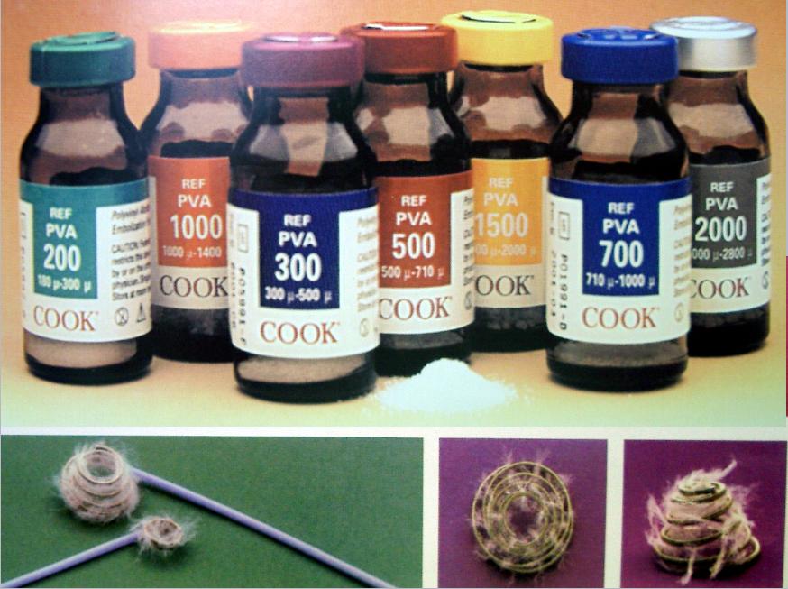 血管栓塞术治疗肿瘤,血管介入栓塞治肿瘤